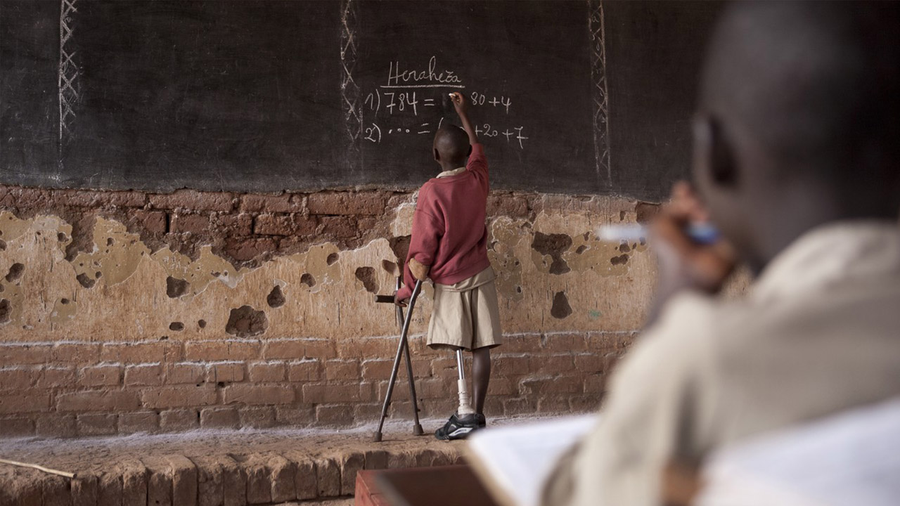 A young boy with a prosthetic leg holds his crutches in one hand and is writing with chalk on a chalkboard. 